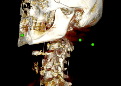 Cranial and Spine Imaging